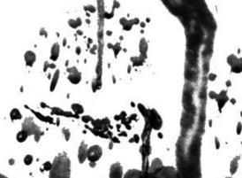 Splatter