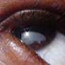 I-profile
