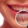 Dental-implant