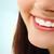 Veneers-smile-370x265